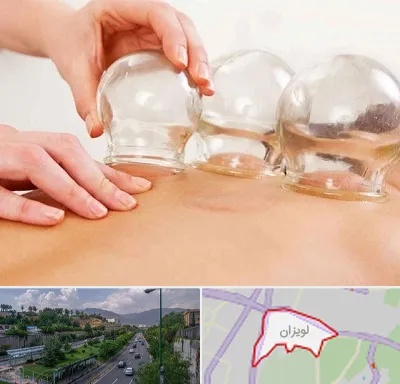 بادکش درمانی در لویزان