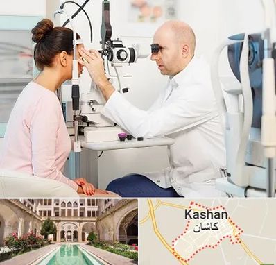 چشم پزشکی شبانه روزی در کاشان