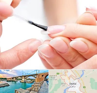 ترمیم کار ناخن در دزفول