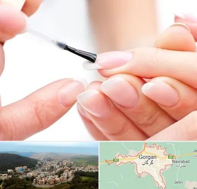 ترمیم کار ناخن در گرگان