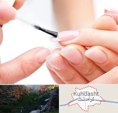 ترمیم کار ناخن در کوهدشت