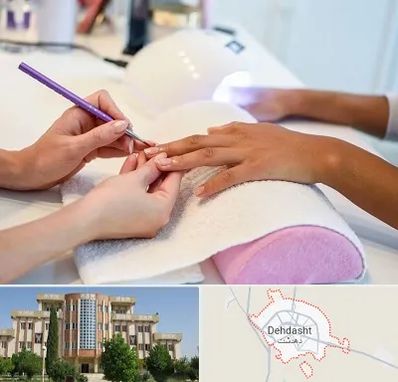 ناخن کار در دهدشت