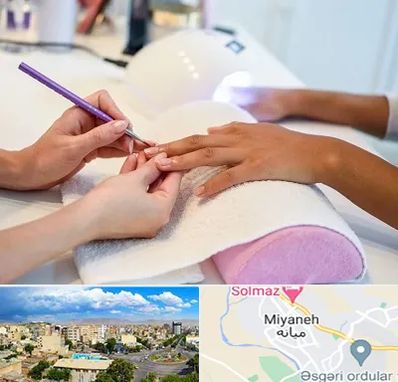 ناخن کار در میانه