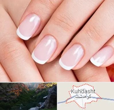لمینت ناخن در کوهدشت