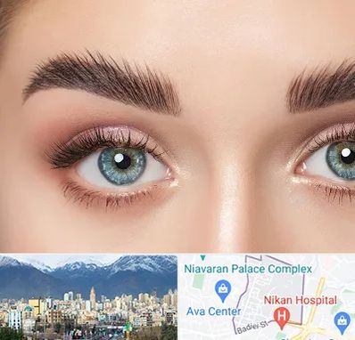 لیفت ابرو در آجودانیه 