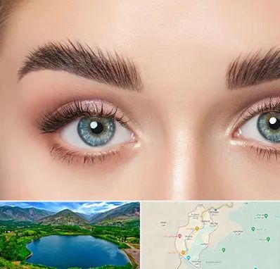 لیفت ابرو در رودبار