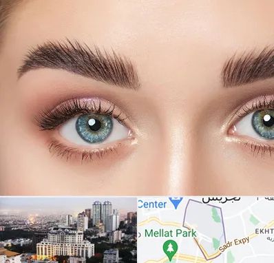 لیفت ابرو در الهیه 