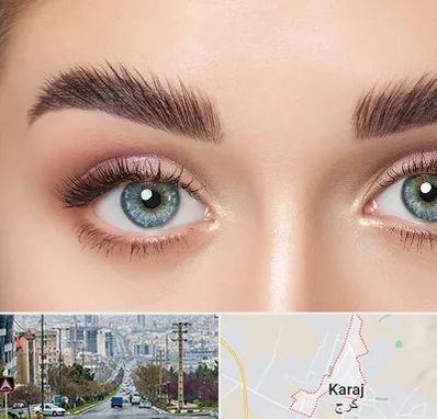 لیفت ابرو در گوهردشت کرج 