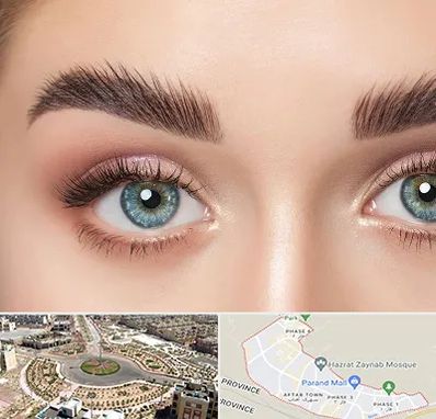 لیفت ابرو در پرند