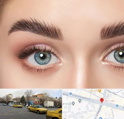 لیفت ابرو در شهناز تبریز