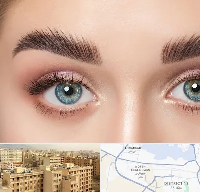 لیفت ابرو در جنوب غرب تهران
