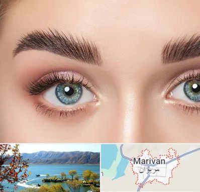 لیفت ابرو در مریوان