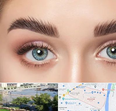 لیفت ابرو در گلستان اهواز