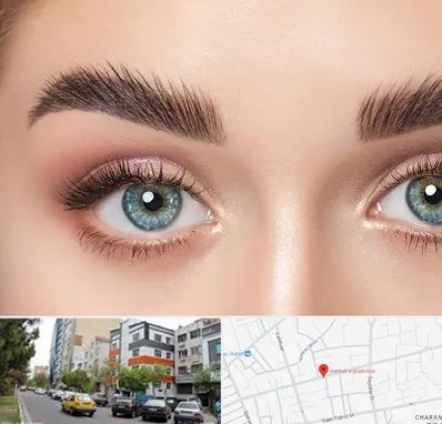 لیفت ابرو در هفده شهریور تبریز