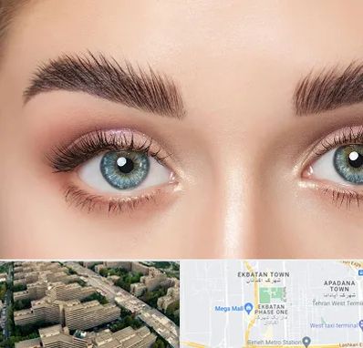 لیفت ابرو در اکباتان 