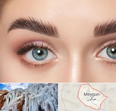 لیفت ابرو در میگون