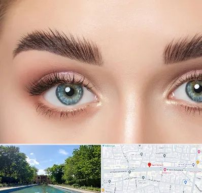 لیفت ابرو در هشت بهشت اصفهان