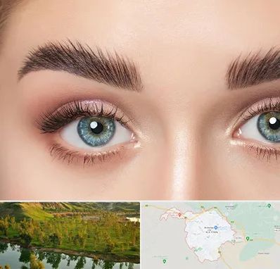 لیفت ابرو در بهبهان