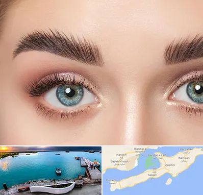 لیفت ابرو در قشم