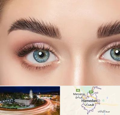 لیفت ابرو در همدان