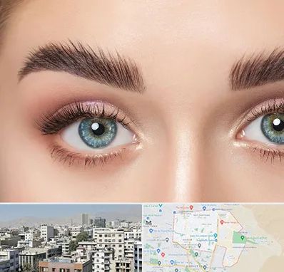 لیفت ابرو در منطقه 14 تهران