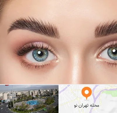 لیفت ابرو در تهران نو