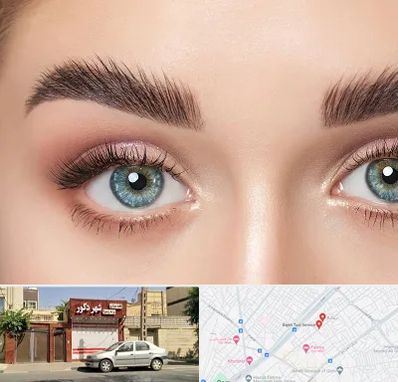 لیفت ابرو در باجک قم