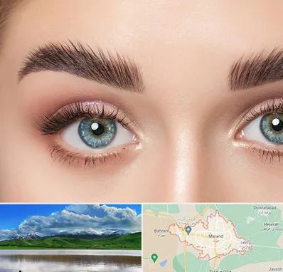 لیفت ابرو در مرند