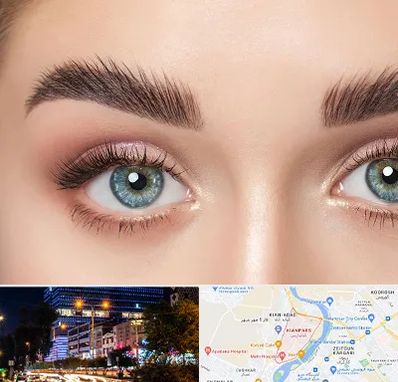 لیفت ابرو در کیانپارس اهواز