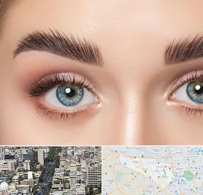 لیفت ابرو در منطقه 18 تهران