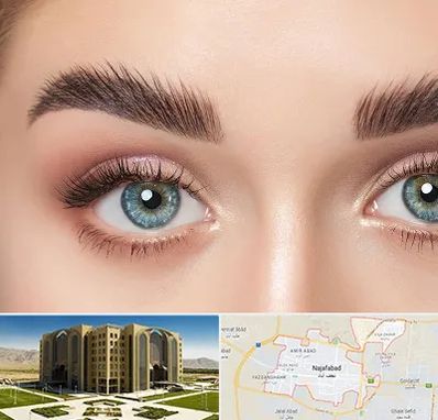 لیفت ابرو در نجف آباد