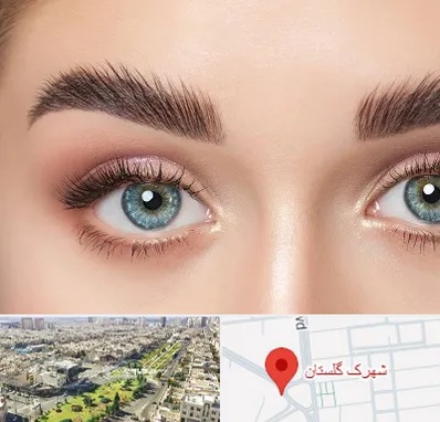 لیفت ابرو در شهرک گلستان