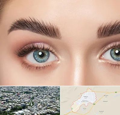 لیفت ابرو در شاهرود