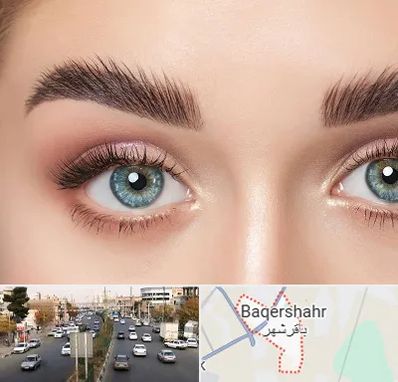 لیفت ابرو در باقرشهر