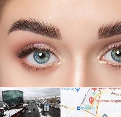 لیفت ابرو در اقدسیه 