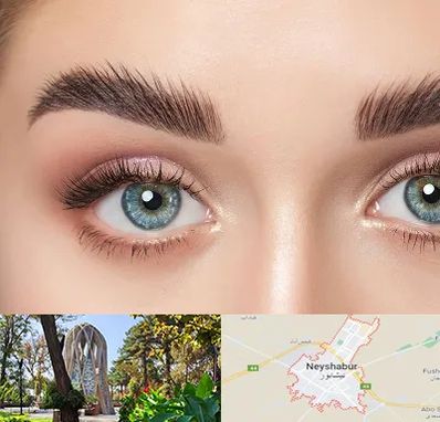 لیفت ابرو در نیشابور