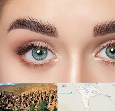 لیفت ابرو در اسکو