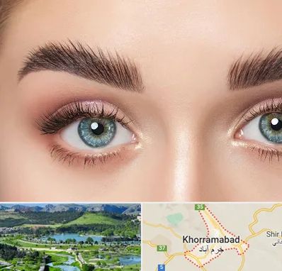 لیفت ابرو در خرم آباد