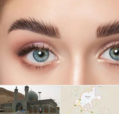 لیفت ابرو در شهرضا