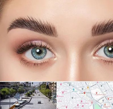 لیفت ابرو در خیابان زند شیراز