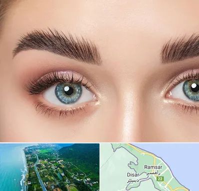لیفت ابرو در رامسر
