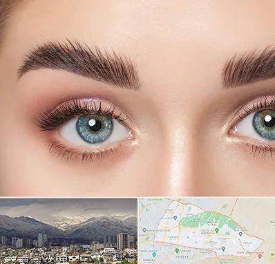 لیفت ابرو در منطقه 4 تهران