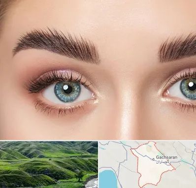 لیفت ابرو در گچساران