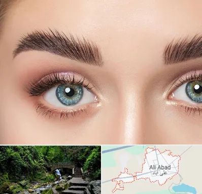 لیفت ابرو در علی آباد کتول