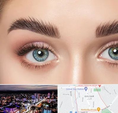 لیفت ابرو در گلسار رشت 