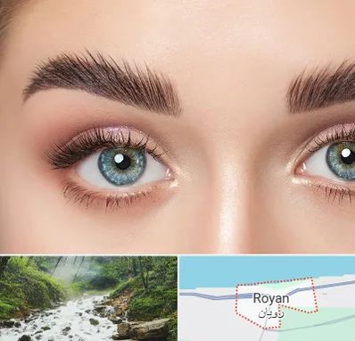 لیفت ابرو در رویان