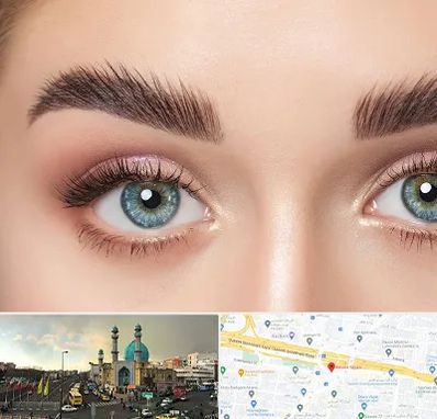 لیفت ابرو در رسالت