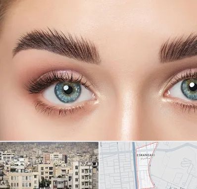 لیفت ابرو در اسکندری