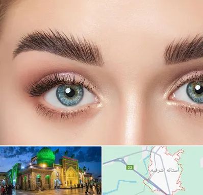 لیفت ابرو در آستانه اشرفیه