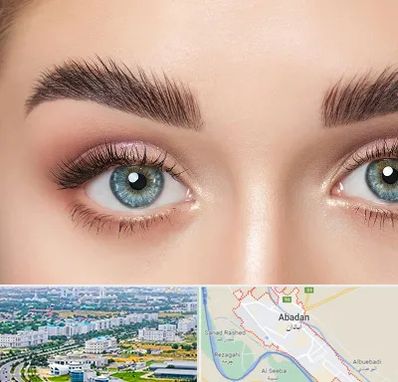 لیفت ابرو در آبادان